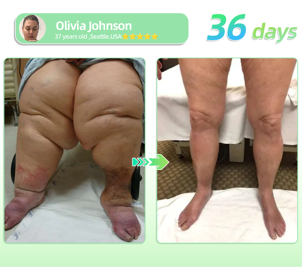 🏆𝐇𝐇𝐕𝐁® 𝐆𝐋𝐏-𝟏 𝐒𝐥𝐢𝐦𝐦𝐢𝐧𝐠 & 𝐇𝐞𝐚𝐥𝐭𝐡 𝐔𝐥𝐭𝐫𝐚 𝐂𝐨𝐧𝐜𝐞𝐧𝐭𝐫𝐚𝐭𝐞𝐝 𝐄𝐬𝐬𝐞𝐧𝐜𝐞 𝐋𝐢𝐪𝐮𝐢𝐝 𝐁𝐞𝐚𝐝𝐬 (𝐉𝐮𝐬𝐭 𝐨𝐧𝐜𝐞 𝐚 𝐝𝐚𝐲, 𝐯𝐢𝐬𝐢𝐛𝐥𝐞 𝐜𝐡𝐚𝐧𝐠𝐞𝐬 𝐢𝐧 𝟕 𝐝𝐚𝐲𝐬） ✅ 𝐅𝐨𝐫 𝐨𝐛𝐞𝐬𝐢𝐭𝐲, 𝐜𝐚𝐫𝐝𝐢𝐨𝐯𝐚𝐬𝐜𝐮𝐥𝐚𝐫 𝐡𝐞𝐚𝐥𝐭𝐡, 𝐝𝐢𝐚𝐛𝐞𝐭𝐞𝐬, 𝐬𝐥𝐞𝐞𝐩 𝐚𝐩𝐧𝐞𝐚, 𝐆𝐮𝐭 𝐇𝐞𝐚𝐥𝐭𝐡, 𝐣𝐨𝐢𝐧𝐭 𝐢𝐬𝐬𝐮𝐞𝐬, 𝐚𝐧𝐝 𝐦𝐨𝐫𝐞